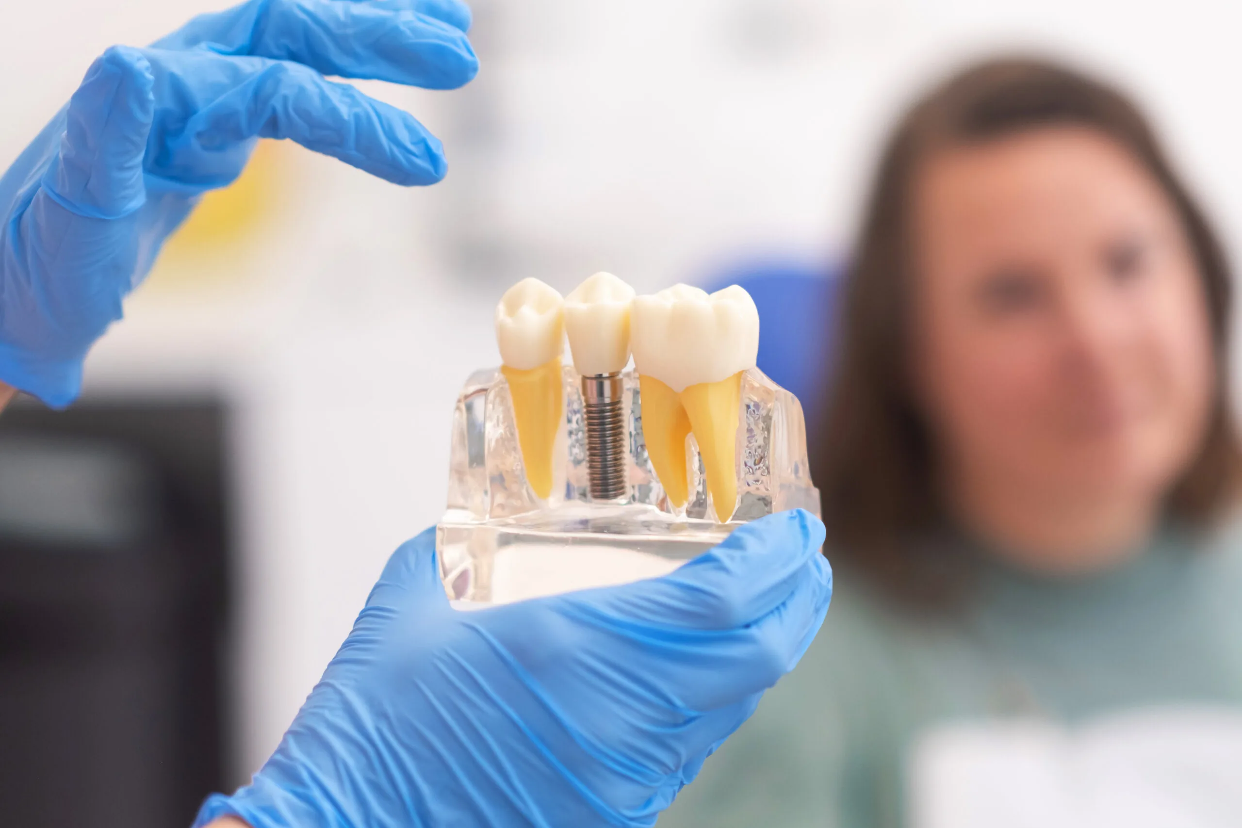 Коронки на передние зубы в Ташкенте: секреты естественной эстетики